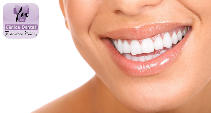 ¡Deslumbra con tu nueva sonrisa! Blanqueamiento Dental en Clínica Dental Francisco Núñez