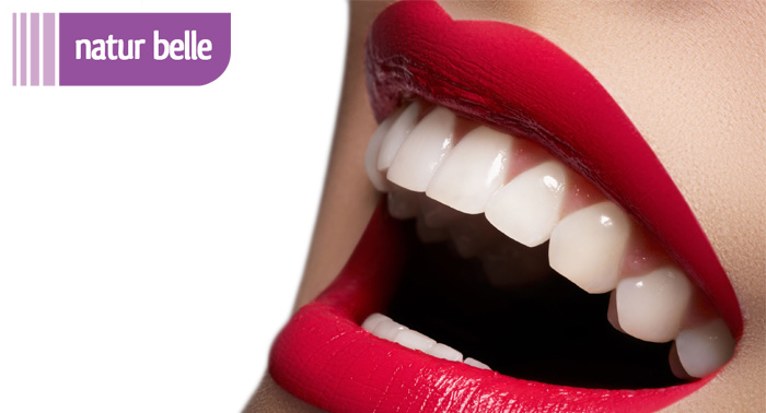 ¡Luce tu mejor sonrisa! Blanqueamiento Dental en Natur Belle de 5 a 10 tonos asegurados.