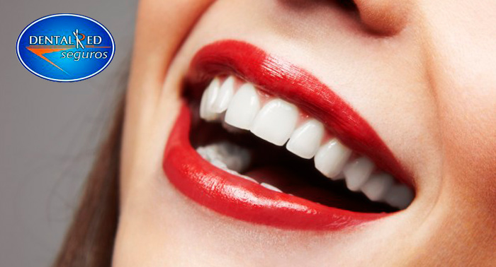 Sonrie a la vida: Limpieza dental, revisión con diagnóstico, radiografía, y pulido de manchas 