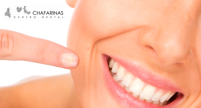 Blanqueamiento Dental con Férulas blandas,Revisión, Diagnostico,Radriogafía