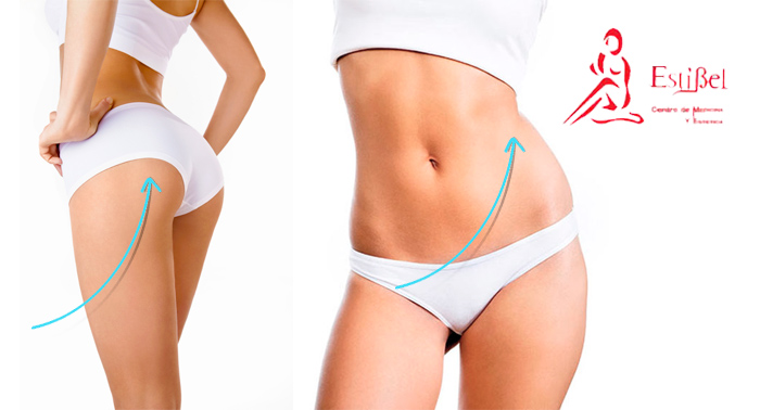 Rejuvenece sin dolor y con resultados al instante: 6 o 12 Hilos reafirmantes de rostro y cuerpo