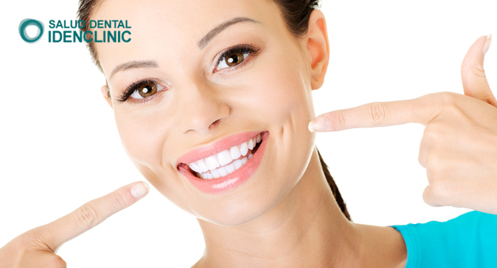 Blanqueamiento Dental con Férulas blandas, Revisión, Diagnóstico y Limpieza