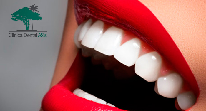 Regala un Blanqueamiento Dental LED + limpieza bucal con pulido y fluorización