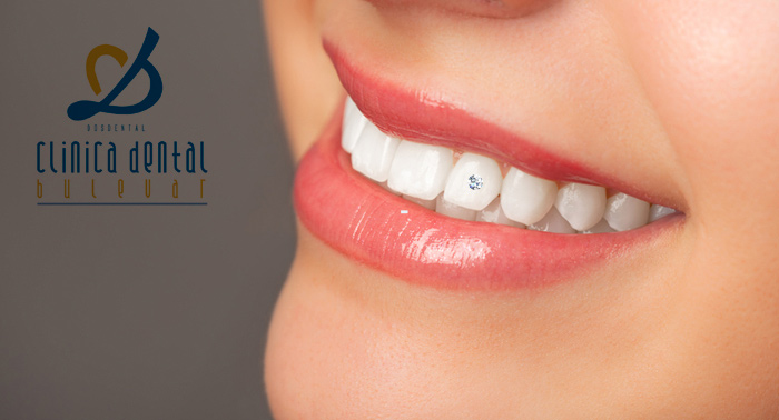 ¡Haz tu sonrisa brillar! Regala la mejor sonrisa gracias al tratamiento Skyce Brillante Dental.