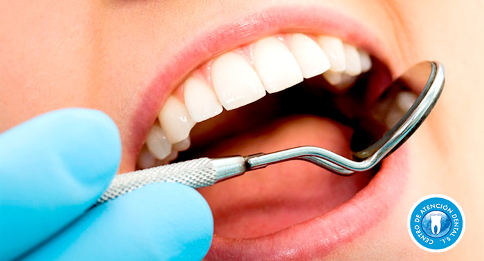 Deslumbra con una sonrisa perfecta: Blanqueamiento Dental en Policlínica Bonoden.