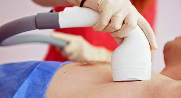 3 o 5 Sesiones de depilación con láser de diodo en zona a elegir 