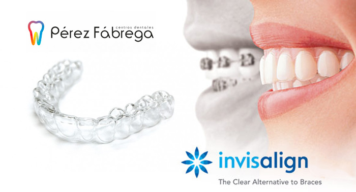 Ortodoncia + Radiografías + Estudio + Brackets Metálicos-Invisalign® + 3 Revisiones + Limpieza