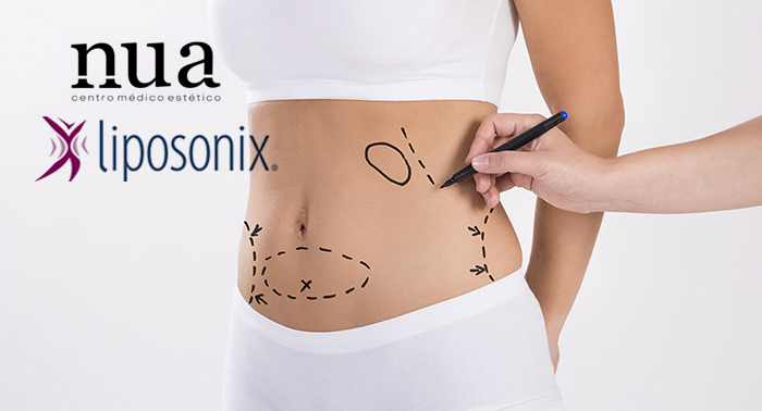 El tratamiento revolucionario contra la grasa localizada: Liposonix. ¡Di NO al quirófano!