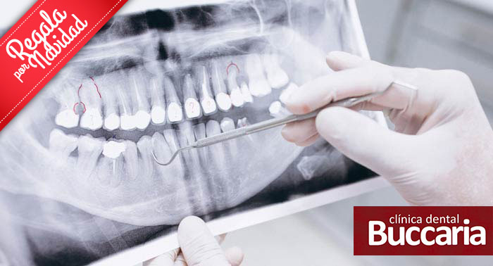 Salud Bucal: Revisión + Radiografía Panorámica + Limpieza Dental + Pulido Manchas