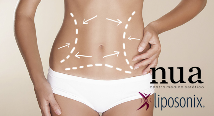 El Tratamiento Revolucionario contra la grasa localizada: Liposonix. ¡Di NO al quirófano!