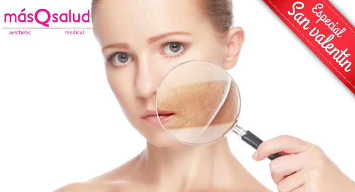 Eliminación de manchas en la piel con Ténica Q-Switched: ¡Dile adiós para siempre!