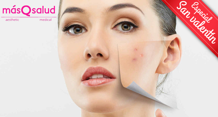 Eliminación de manchas en la piel con Ténica Q-Switched: ¡Dile adiós para siempre!
