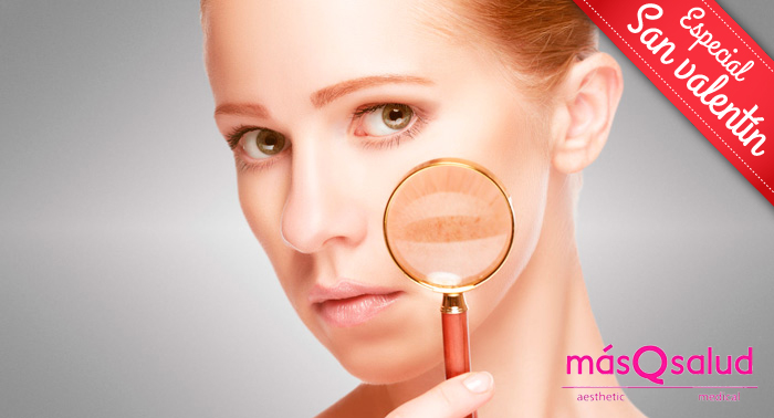 Eliminación de manchas en la piel con Ténica Q-Switched: ¡Dile adiós para siempre!