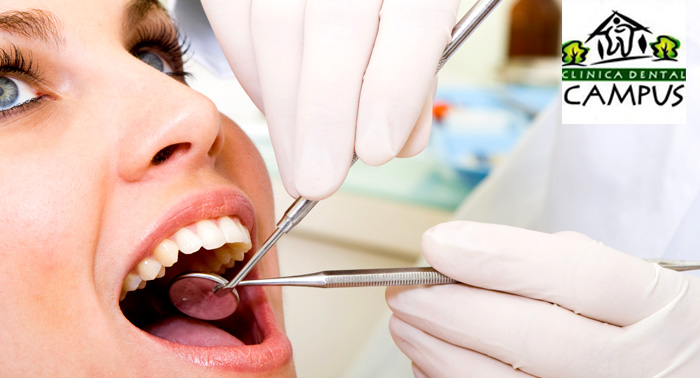 Limpieza Bucal con Revisión y Pulido. ¡Luce una sonrisa para enamorar! 