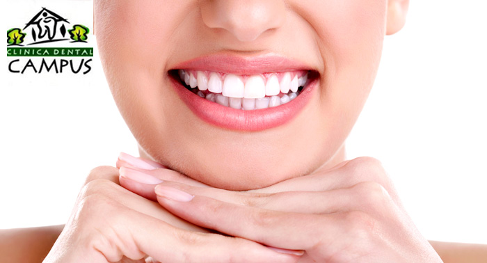 Limpieza Bucal con Revisión y Pulido. ¡Luce una sonrisa para enamorar! 