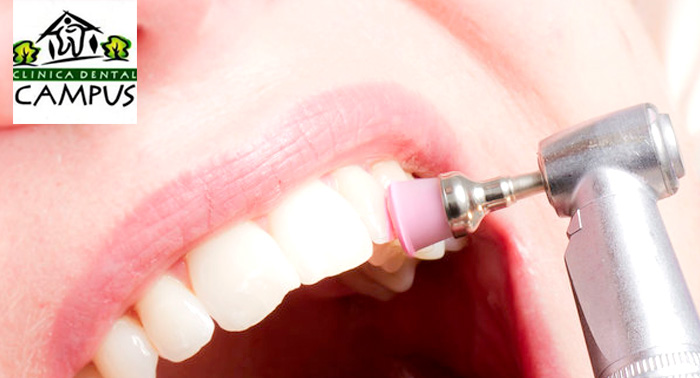 Limpieza Bucal con Revisión y Pulido. ¡Luce una sonrisa para enamorar! 