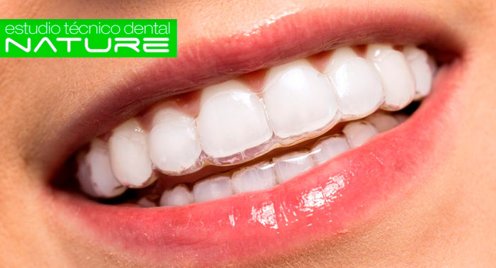 Una dentadura perfecta: Férula de Descarga Dental o Michigan o Prótesis Fija de Metal-Porcelana
