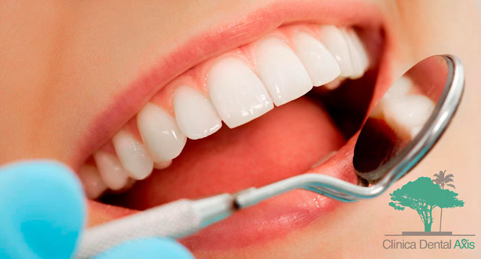 ¡Sonríe a la vida! Limpieza Dental + Revisión con Diagnóstico + Radiografía + Pulido Manchas 