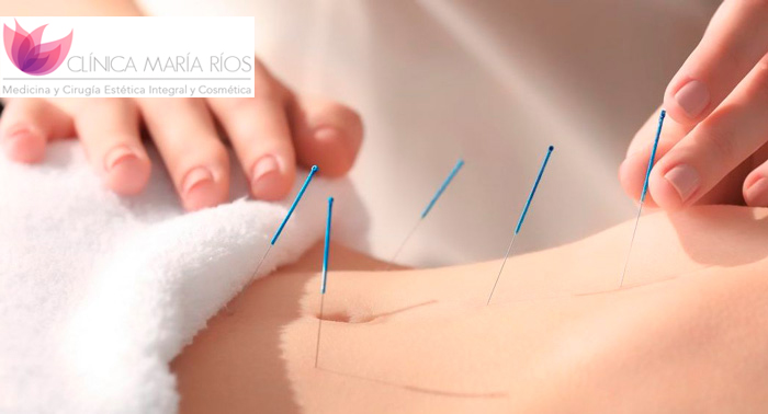 ¡Pierde de 3 a 8kg! Tratamiento de Nutrición con Control de Peso + Dieta Detox + Acupuntura 