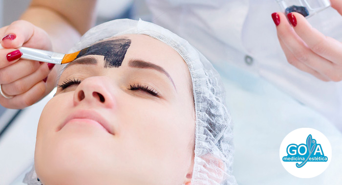 ¡Regenera y rejuvenece tu piel! 1, 2 o 3 Sesiones de Láser Carbon Peel Facial
