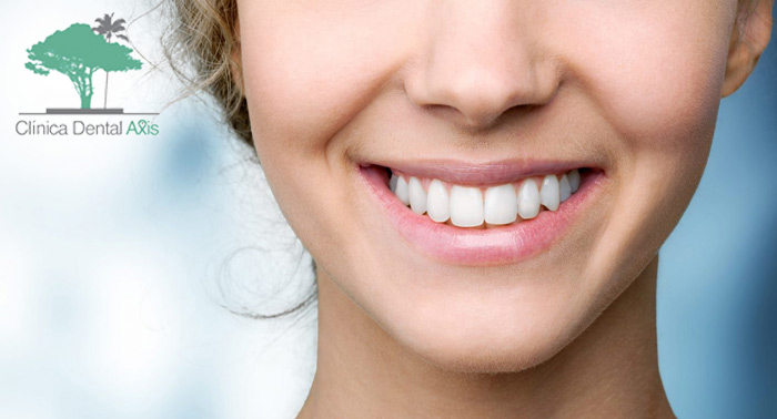 ¡Luce sonrisa! Limpieza Dental + Revisión con Diagnóstico + Radiografía + Pulido de Manchas 