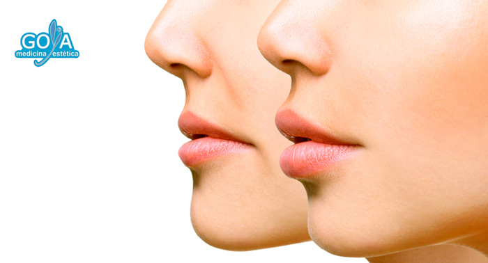 ¡Luce unos labios más gruesos e hidratados! 1, 2 o 3 Sesiones de Tratamiento Lip Sculpt