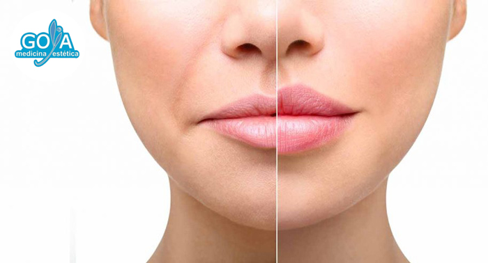 ¡Luce unos labios más gruesos e hidratados! 1, 2 o 3 Sesiones de Tratamiento Lip Sculpt