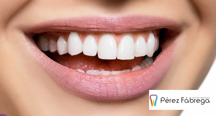 ¡Luce sonrisa! Ortodoncia + Radiografías + Estudio + Brackets + 3 Revisiones + Limpieza
