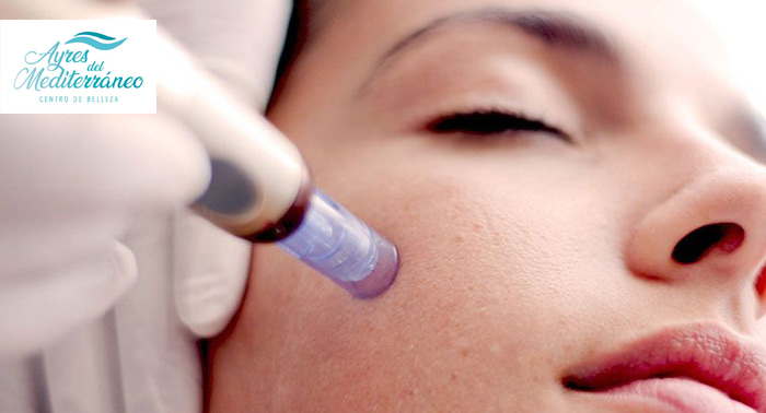 ¡Luce joven! Rejuvenecimiento Facial + Limpieza + Mascarilla con opción a Microneedling