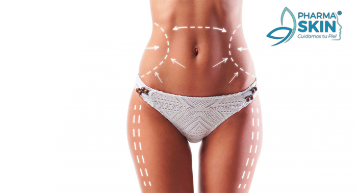 ¡Anti-grasa sin cirugía! Tratamiento Liposonix + 15 días de Fitoterapia en Paharmaskin