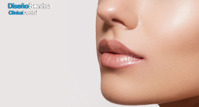 ¡Labios perfectos! Relleno de Labios con Ácido Hialurónico en Clínica Dental Diseño Sonrisa