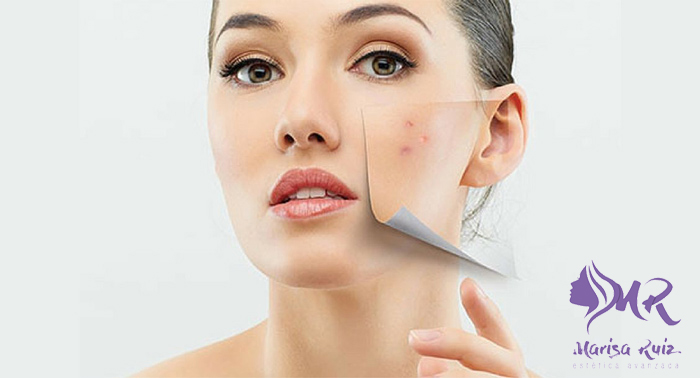 ¡Luce un rostro perfecto! Diagnóstico + Tratamiento Facial Antimanchas + Seguimiento 