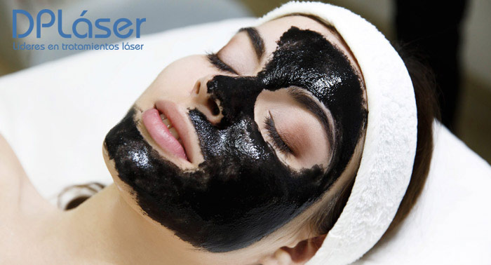 1 o 3 Sesiones de Peeling de Carbón Activo o Radiofrecuencia Facial Vela Smooth