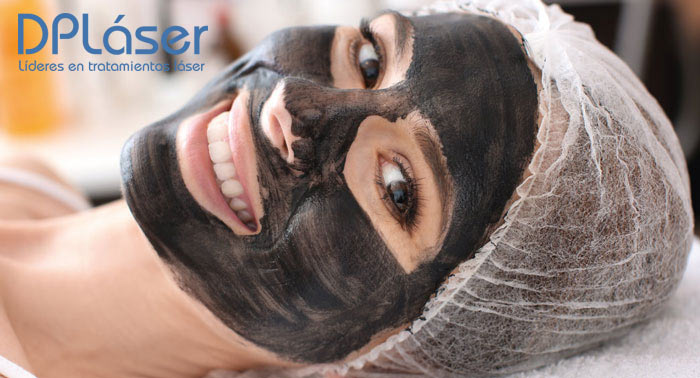 1 o 3 Sesiones de Peeling de Carbón Activo o Radiofrecuencia Facial Vela Smooth