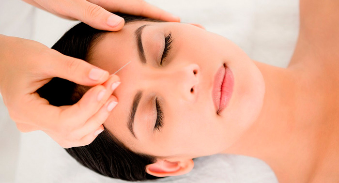 Sorpréndete con este Lifting Facial con Acupuntura para reducir los signos de la edad