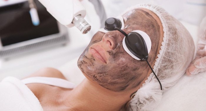 Rejuvenece tu rostro con 1, 2 o 3 Sesiones de Láser Carbon Peel Facial