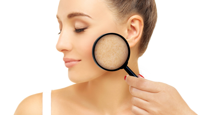 ¡Luce un rostro perfecto! Diagnóstico + Tratamiento Facial Antimanchas + Seguimiento 