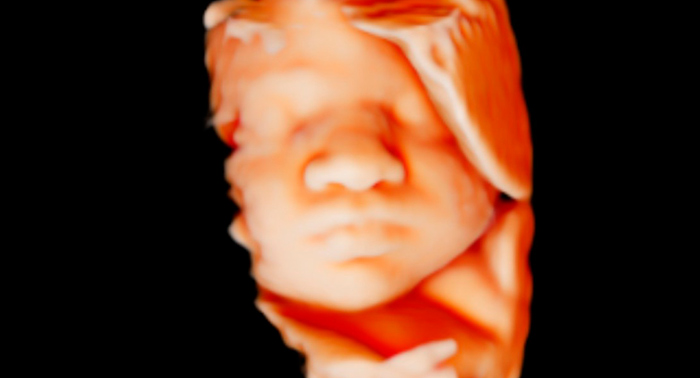 Un Regalo inolvidable: Ecografía Emocional 4D/5D para poder ver la carita de tu bebé