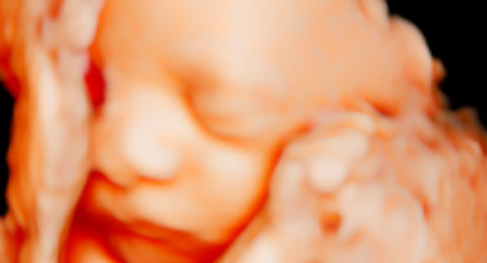 Un Regalo inolvidable: Ecografía Emocional 4D/5D para poder ver la carita de tu bebé