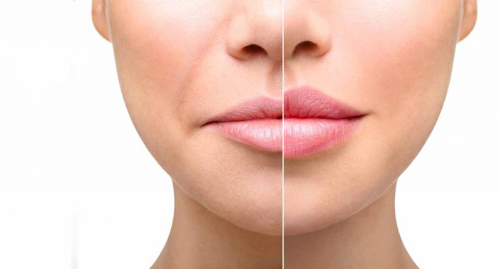 Hidratación de Labios en Alicia de los Reyes: ¡Luce unos labios más gruesos e hidratados!