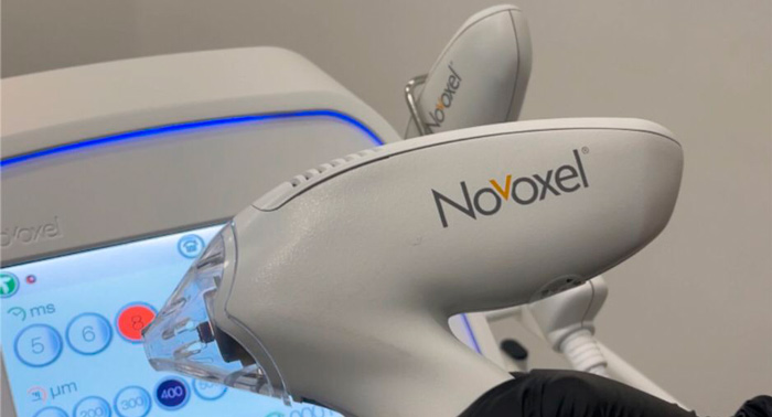 Regala Tixel esta Navidad: Tecnología de vanguardia para el rejuvenecimiento facial.