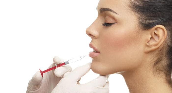 ¡Labios perfectos! Relleno de Labios con Ácido Hialurónico en Clínica Dental Diseño Sonrisa