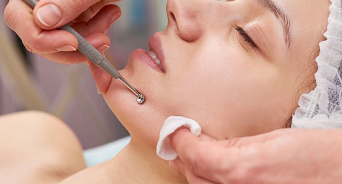 Tratamiento Renew Skin: Limpieza Facial con Punta de diamante + Hidratación y Fototerapia