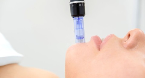 ¡Piel perfecta! Tratamiento Dermapen con Mascarilla Facial y Fototerapia con Máscara LED