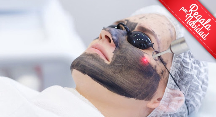 Regala belleza: 1 o 3 Sesiones de Peeling de Carbón Activo o Radiofrecuencia Facial Vela Smooth