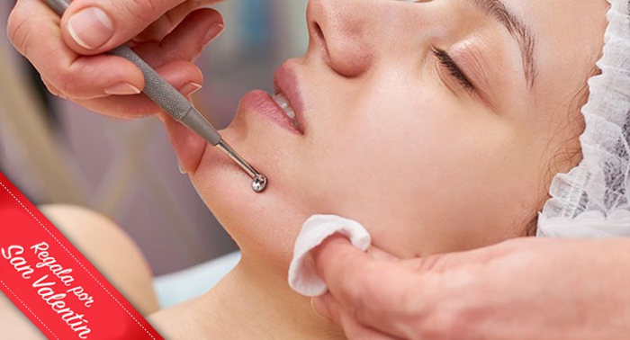 Prepara tu piel con Renew Skin: Limpieza Facial Punta de diamante + Hidratación y Fototerapia