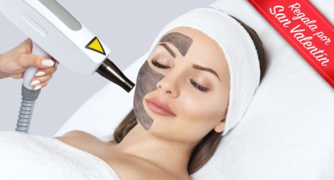 !Regalazo! Rejuvenece el rostro con 1, 2 o 3 Sesiones de Láser Carbon Peel Facial