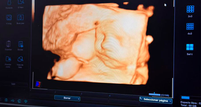 Ecografía ecolatido/5D. Envío de todas las fotos y 1 Impresión de la foto favorita