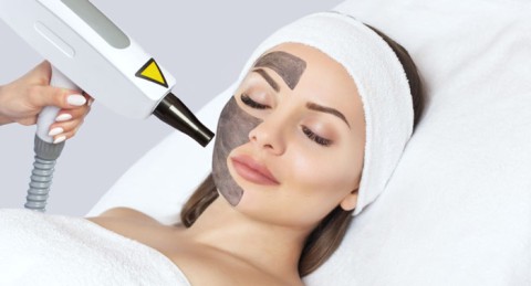 !Regalazo! Rejuvenece el rostro con 1, 2 o 3 Sesiones de Láser Carbon Peel Facial