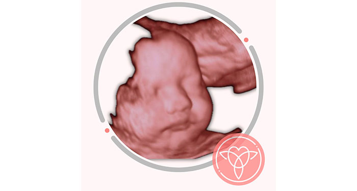 Ecografía ecolatido/5D. Envío de todas las fotos y 1 Impresión de la foto favorita